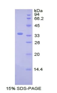 Human CDK4 Protein (Recombinant His)