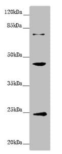 Polyclonal Rabbit anti-Human GNA15 Antibody (IHC, WB)