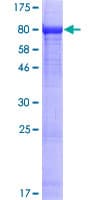 Human EXD1 Protein (Recombinant GST)
