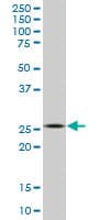 APG5 / ATG5 Antibody (clone 1G11)