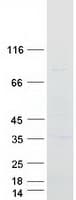 Human SLC35A4 Protein (Recombinant Myc-DDK (Flag))