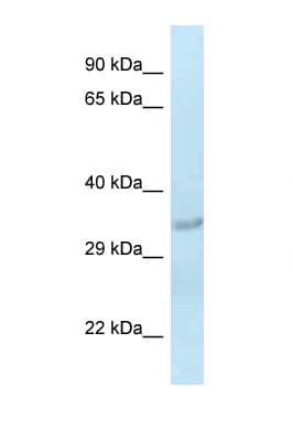 Polyclonal Rabbit anti-Rat SULT1C2 / Sulfotransferase 1C2 Antibody (aa70-119, WB)