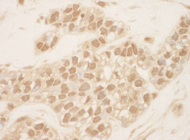 Polyclonal Rabbit anti-Human CUL2 / Cullin 2 Antibody (aa150-200, IHC)