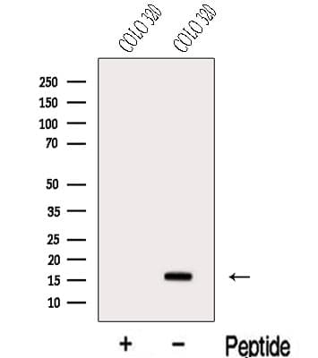 NUT2 / MED10 Antibody
