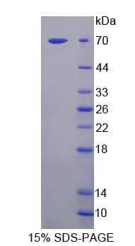 Human MAN1A1 Protein (Recombinant)