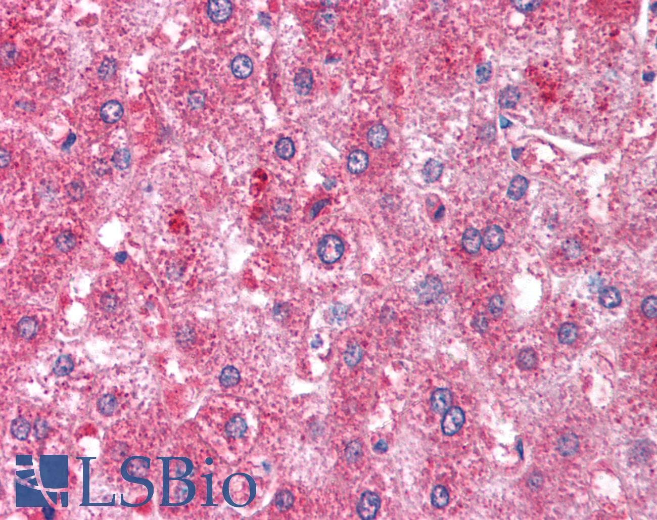 IHC-plus™ ATM Antibody