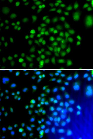 ATF7 Antibody