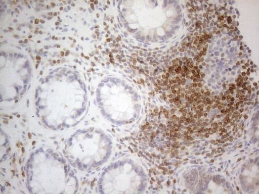 BCL2 / Bcl-2 Antibody (clone UMAB225)
