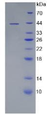 Human CD19 Protein (Recombinant GST, N-terminus)