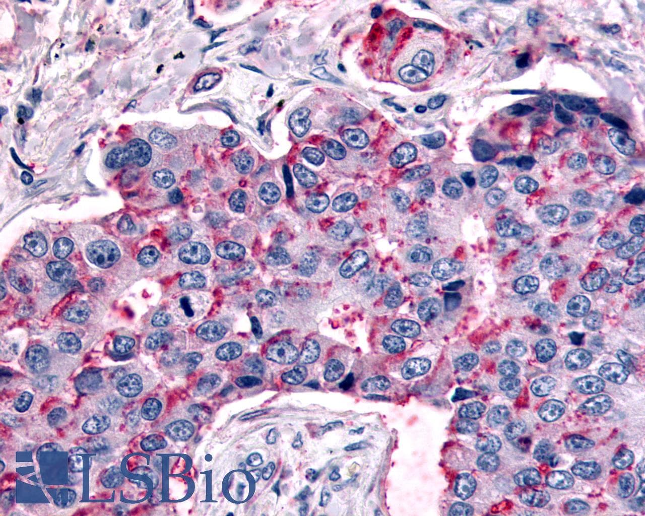 PathPlus™ MRGPRX4 / MRGX4 Antibody (C-Terminus)