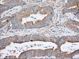 TTC32 Antibody (clone OTI1F7)
