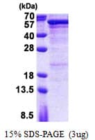 Human SEMG1 Protein (Recombinant His)