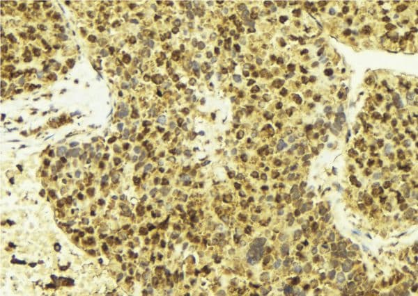 ER Alpha / Estrogen Receptor Antibody