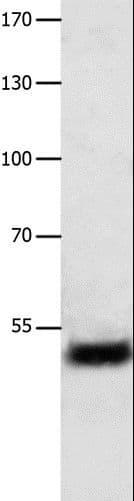 EF1G / EEF1G Antibody