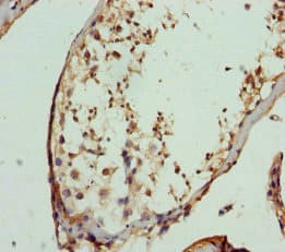 FBXO7 Antibody