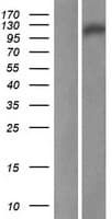 DDIAS Protein (Over-Expression Lysate Myc-DDK (Flag))