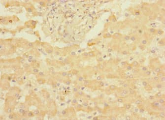 Polyclonal Rabbit anti-Human CHRNE Antibody (IHC)