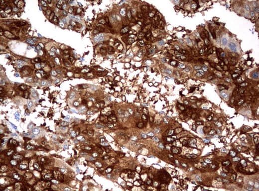 FTCD / 58K Golgi Protein Antibody (clone UMAB122, Carrier-free)