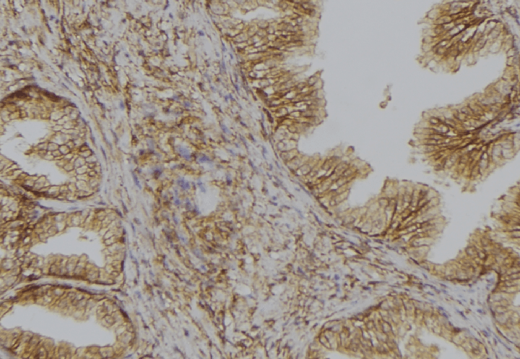 SLC6A4 / SERT Antibody
