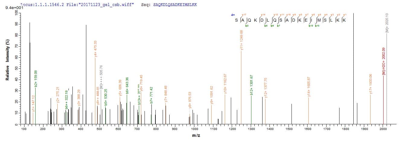 Human TRAIP / TRIP Protein (Recombinant 10His, N-terminus)