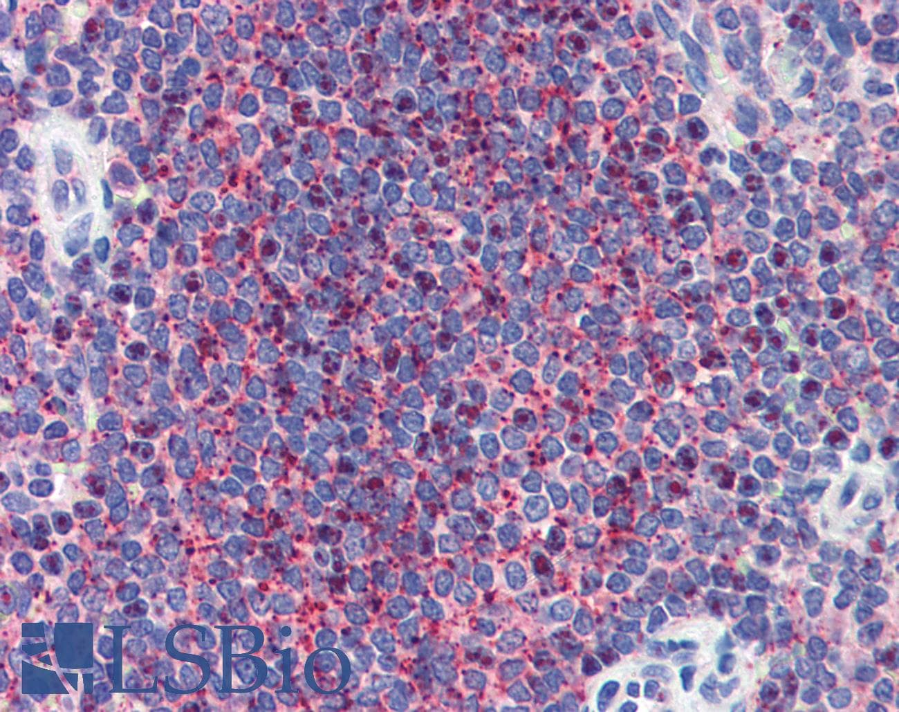 LIN28A / LIN28 Antibody (N-Terminus)