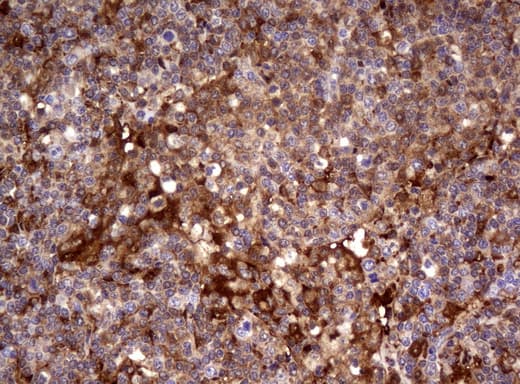 TP / Thymidine Phosphorylase Antibody (aa311-482, clone UMAB97)