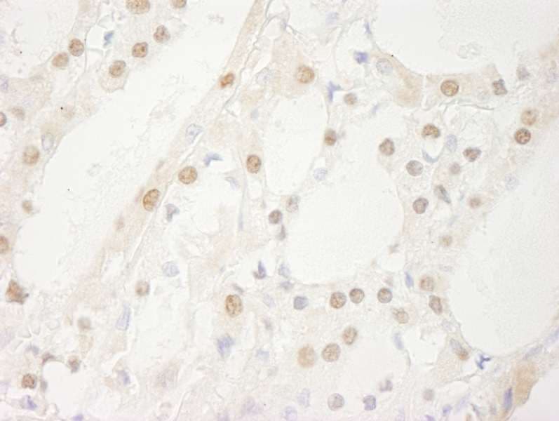 Polyclonal Rabbit anti-Human USP1 Antibody (aa450-500, IHC)