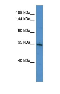 Polyclonal Rabbit anti-Human SIK3 / QSK Antibody (aa525-574, WB)