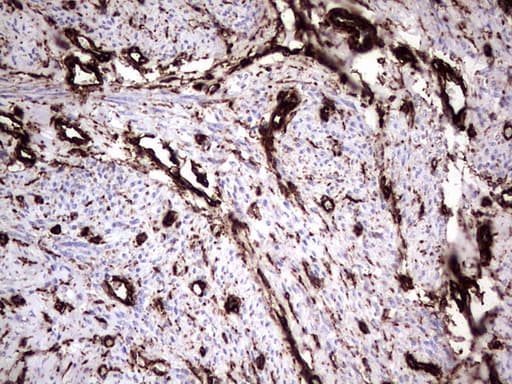 Vimentin Antibody (aa210-466, clone UMAB159)