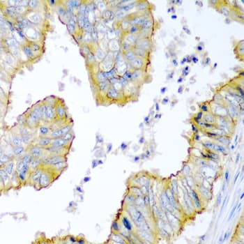 ZNF673 Antibody