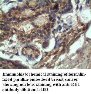 Polyclonal Rabbit anti-Human RB1 / Retinoblastoma / RB Antibody (IHC, WB)