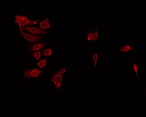 ANKK1 Antibody