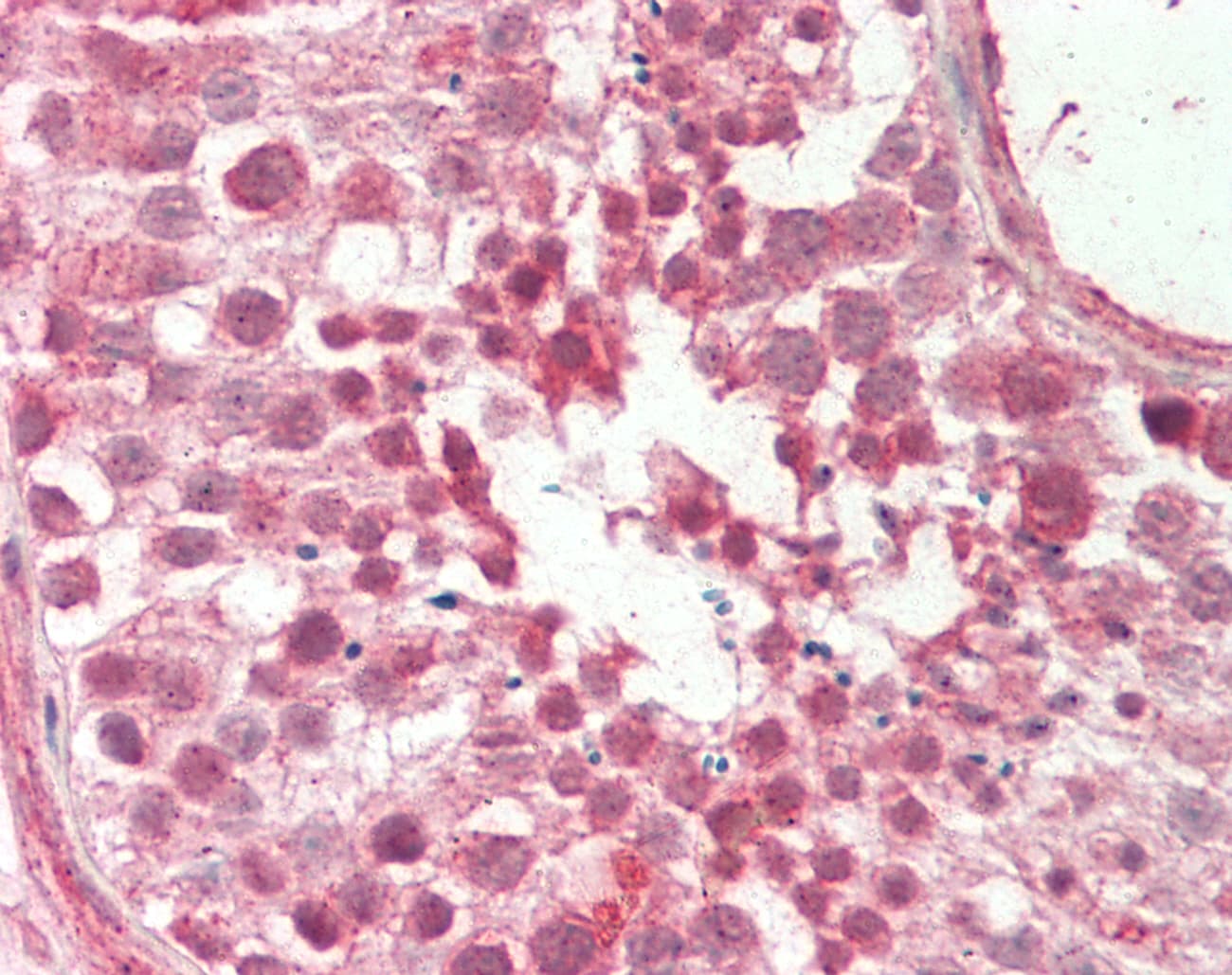 RAIG2 / GPRC5B Antibody (aa61-110)