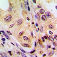 Polyclonal Rabbit anti-Human BRAF / B-Raf Antibody (Internal, IHC, IF, WB)