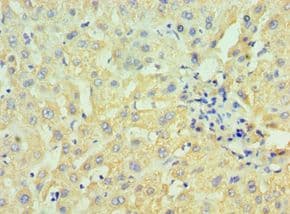 HSD17B4 Antibody (aa437-736)