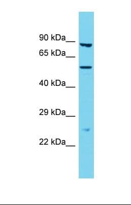 Polyclonal Rabbit anti-Human TMPRSS9 Antibody (aa48-97, WB)