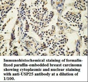 Polyclonal Rabbit anti-Human USP25 Antibody (aa2-220, IHC, WB)