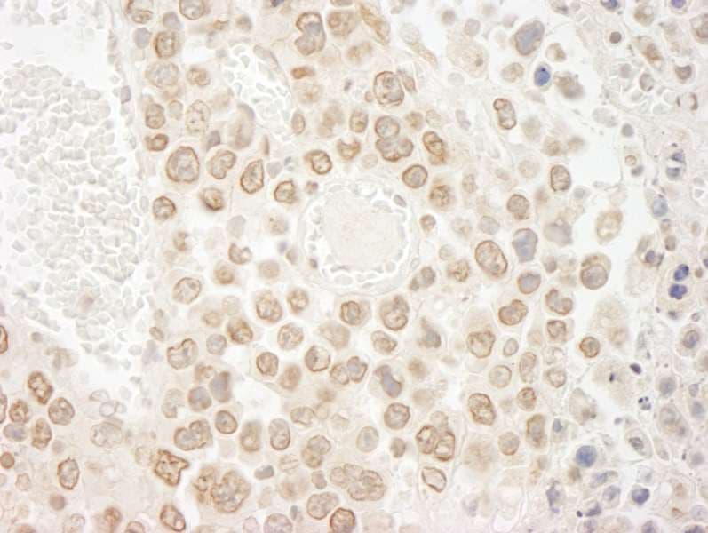 DTL / CDT2 Antibody (aa680-C-term)