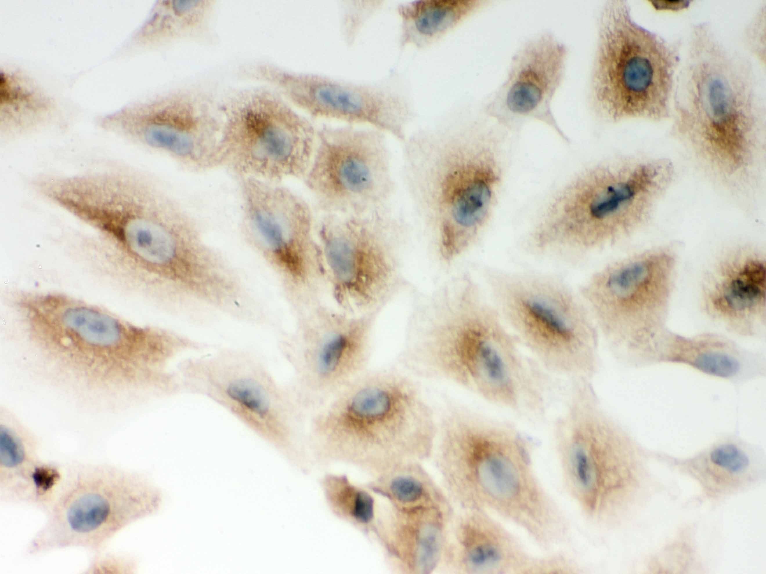 NOD1 Antibody (aa1-160)