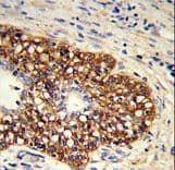 PGIS / PTGIS Antibody (aa472-500)