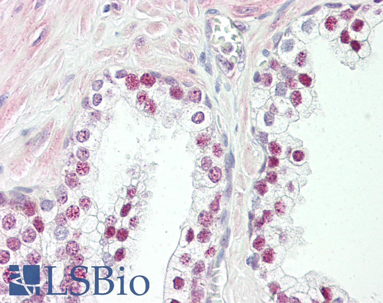 IHC-plus™ HMGXB3 / SMF Antibody (aa131-180)