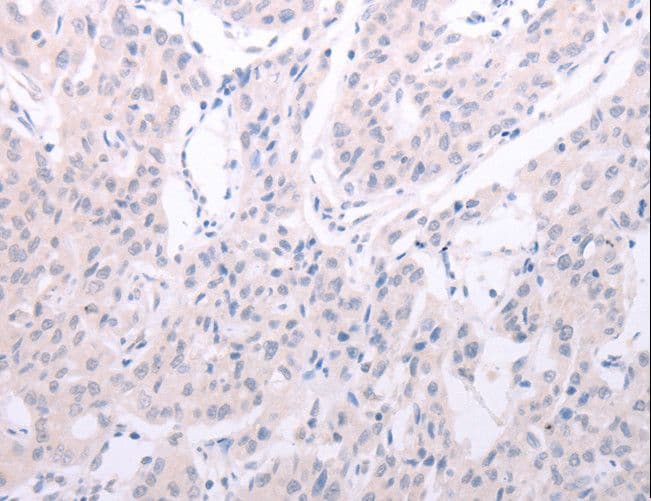 SPATA6 / SRF-1 Antibody
