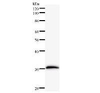 FOXL2 Antibody (clone 262C1a)