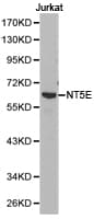 Polyclonal Rabbit anti-Human NT5E / eNT / CD73 Antibody (IHC, WB)