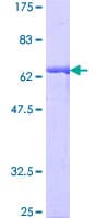 Human GIPC1 / GIPC Protein (Recombinant GST)
