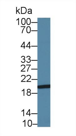 CDH13 / Cadherin 13 Antibody