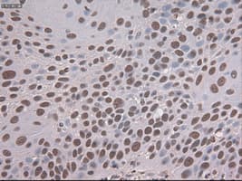 NOTCH1 Antibody (clone OTI4C9)