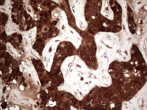 LGALS3 / Galectin 3 Antibody (clone OTI2F1)