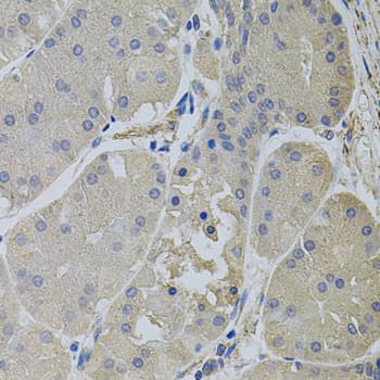 IHC-plus™ CLTC / Clathrin Heavy Chain Antibody