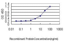 KRT18 / CK18 / Cytokeratin 18 Antibody (clone 2F8)
